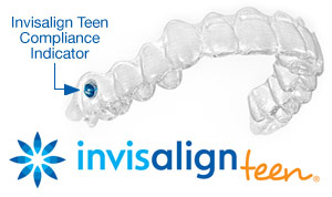 Invisalign teen.